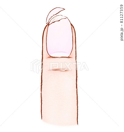 二枚爪と指のイラスト 81127359