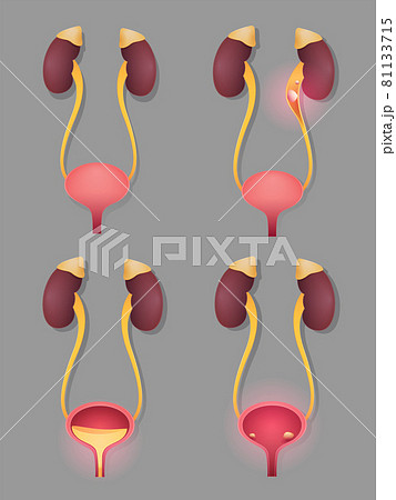 Illustration of the kidney and bladder 81133715
