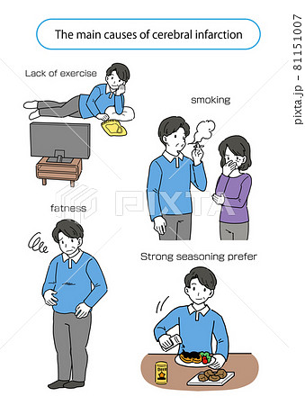 脳梗塞になる主な原因をまとめたイラスト（英語版） 81151007