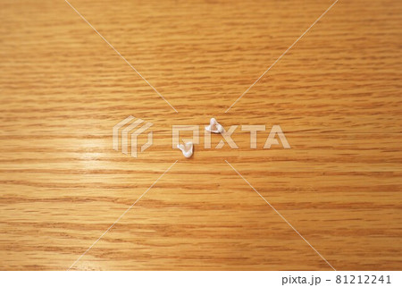 犬の歯の生え変わり(乳歯) 犬の歯の生え変わり(乳歯) 81212241