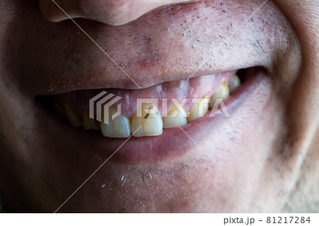 悪意ある笑み(正面) 悪意ある笑み(正面) 81217284