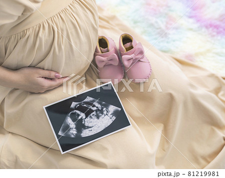 妊婦イメージ　マタニティフォト　エコー写真 81219981