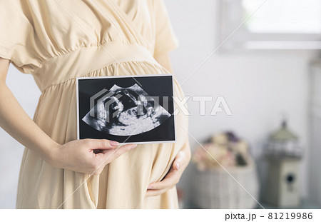 エコー写真を持つ妊婦イメージ マタニティフォト エコー写真を持つ妊婦イメージ マタニティフォト 81219986