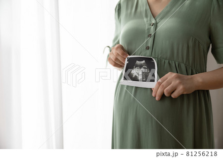 Pregnant woman showing unborn baby sonogram image at camera 81256218