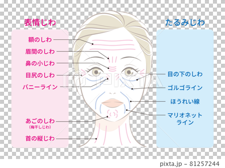 皺紋類型 81257244