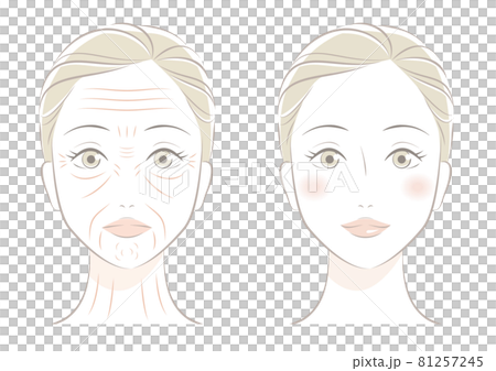 女性の顔のしわ 81257245