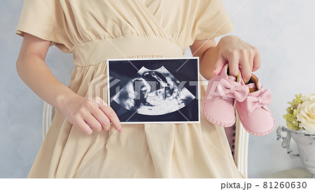 妊婦イメージ　マタニティフォト　エコー写真 81260630