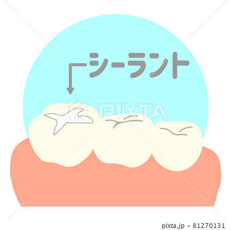 シーラント 81270131