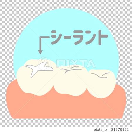 シーラント 81270131