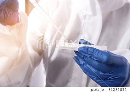 Checking the water quality. Scientist dripping a drop of water onto a test strip to determine the quality of water 81285832