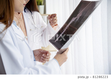 Two asian women doctors discuss meeting doctor's office medical clinic looking x-ray film consulting patient disease. Asian medical lab young women talking together discussing healthcare teamwork Two asian women doctors discuss meeting doctor's office medical clinic looking x-ray film consulting patient disease. Asian medical lab young women talking together discussing healthcare teamwork 81286223