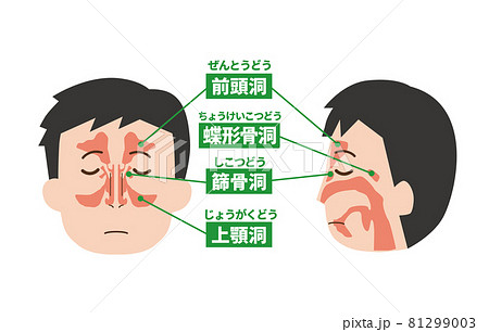 鼻の内部イメージ正面と側面 鼻の内部イメージ正面と側面 81299003