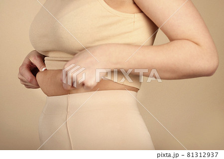 Hands makes fold of skin on stomach Hands makes fold of skin on stomach 81312937