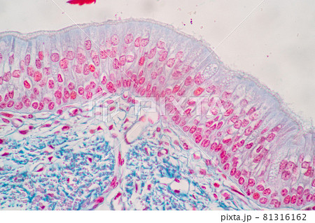 Characteristics of Columnar epithellum cell (Cell structure) of human under microscope view for education in laboratory. Characteristics of Columnar epithellum cell (Cell structure) of human under microscope view for education in laboratory. 81316162