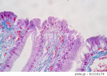 Characteristics of Columnar epithellum cell (Cell structure) of human under microscope view for education in laboratory. Characteristics of Columnar epithellum cell (Cell structure) of human under microscope view for education in laboratory. 81316179