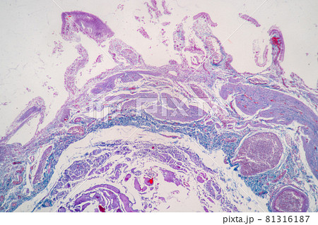 Characteristics of Columnar epithellum cell (Cell structure) of human under microscope view for education in laboratory. Characteristics of Columnar epithellum cell (Cell structure) of human under microscope view for education in laboratory. 81316187