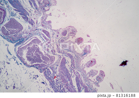Characteristics of Columnar epithellum cell (Cell structure) of human under microscope view for education in laboratory. Characteristics of Columnar epithellum cell (Cell structure) of human under microscope view for education in laboratory. 81316188