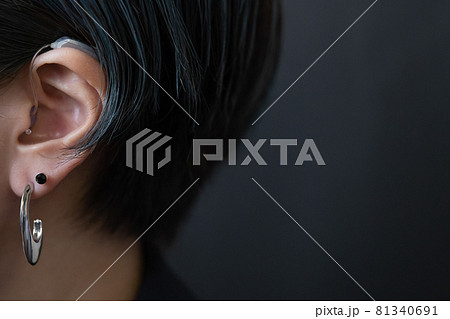 髪で隠れる小さな補聴器 髪で隠れる小さな補聴器 81340691