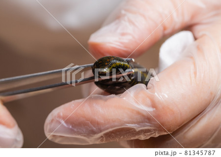 Traditional alternative medicine - doctor doing procedure of hirudotherapy for young woman. 81345787