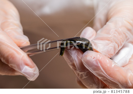 Traditional alternative medicine - doctor doing procedure of hirudotherapy for young woman. 81345788