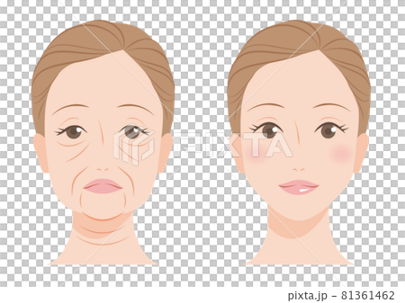 顔のたるみ 81361462