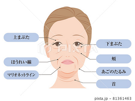 たるみの種類 81361463