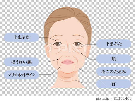 たるみの種類 81361463