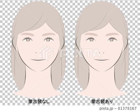 蒙古襞ありなし比較 81378167