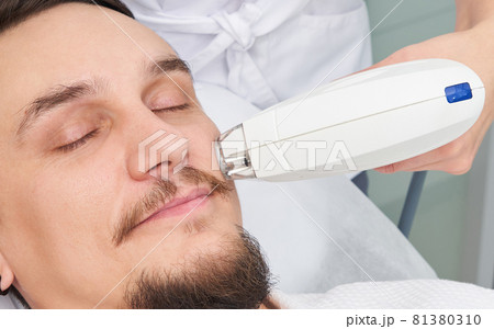 Man Having Laser Treatment At Beauty Clinic Man Having Laser Treatment At Beauty Clinic 81380310