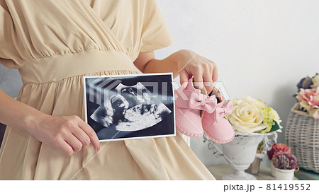 妊婦イメージ　マタニティフォト　エコー写真 81419552