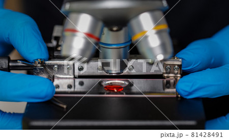 Hands in blue gloves adjisting microscope with red drop of sample liquid under lens of microscope Hands in blue gloves adjisting microscope with red drop of sample liquid under lens of microscope 81428491