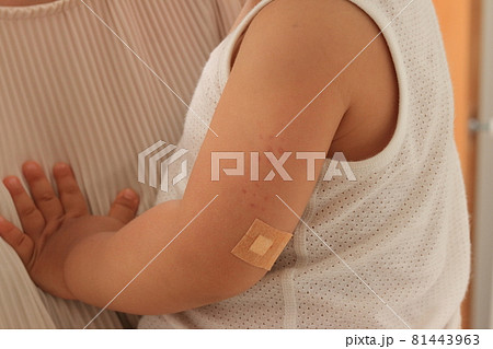 予防接種 81443963
