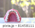 歯科矯正模型 81458111