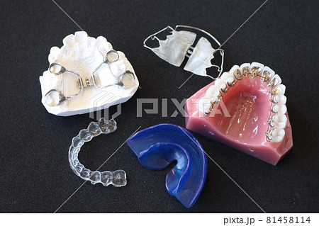 歯科矯正器具 歯科矯正器具 81458114