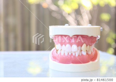 歯科模型 81461500