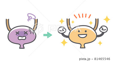 人間の膀胱の病気から回復するビフォーアフター 人間の膀胱の病気から回復するビフォーアフター 81465546