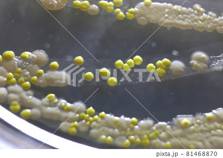 Macro view of bacteria and baker yeast colonies 81468870
