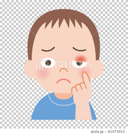 Boy with swollen eyelids 81473915