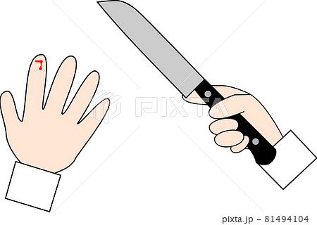 包丁で手を切ったイメージ 包丁で手を切ったイメージ 81494104