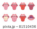 舌診の図表イラスト（漢方相談） 81510436