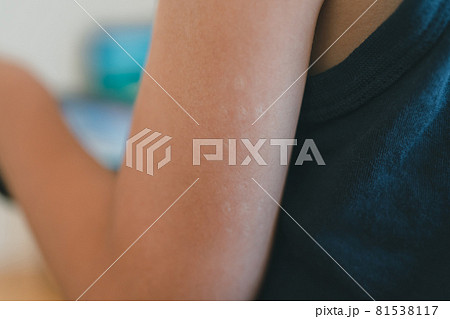 7 years old 81538117