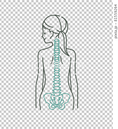 女性背部和脊柱 2 顏色的圖像 81559264