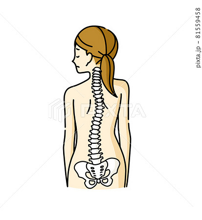 女性の背中と歪んでいる背骨のイメージのイラスト素材