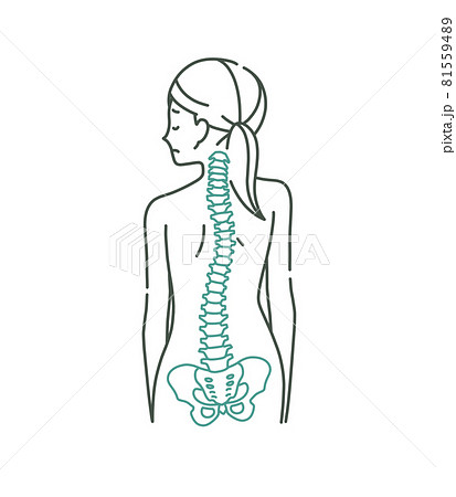 女性の背中と歪んでいる背骨のイメージ 2色のイラスト素材