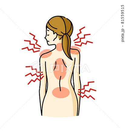 歪んでいる女性の背中と身体の痛み 81559515