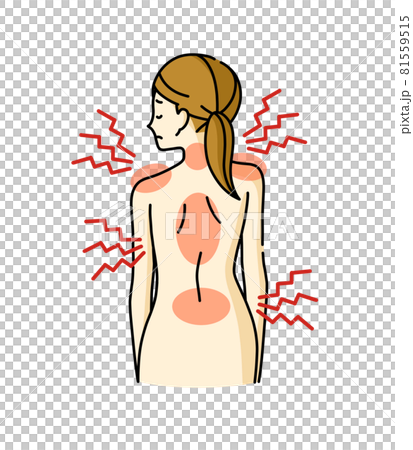 歪んでいる女性の背中と身体の痛み 81559515