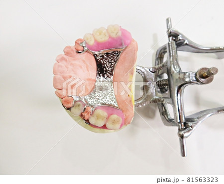 歯科医 フレーム 歯 81563323