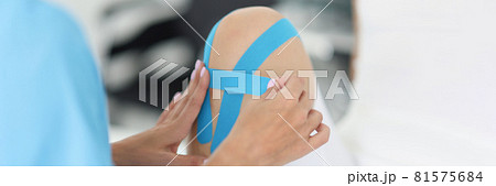 Therapist gluing blue kinesio tapes on woman sore knee closeup Therapist gluing blue kinesio tapes on woman sore knee closeup 81575684
