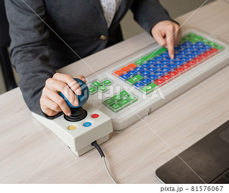 An unrecognizable woman with cerebral palsy is typing on the keyboard. A girl with disabilities works on a specially equipped computer An unrecognizable woman with cerebral palsy is typing on the keyboard. A girl with disabilities works on a specially equipped computer 81576067