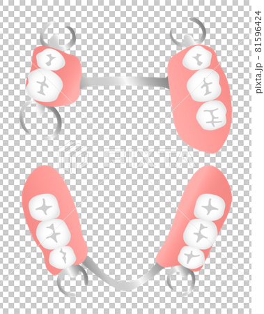 部分入れ歯（咬合面） 81596424